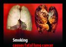 GB: Zigarettenpackungen mit abschreckenden Bildern kommen 2009